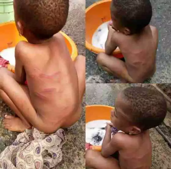 OMG! This Is WICKEDNESS: See What Grandma Did To This Small Girl In Lagos (Graphic Photos)